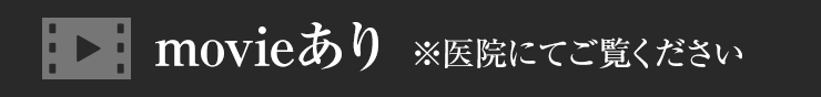 movieあり ※医院にてご覧ください