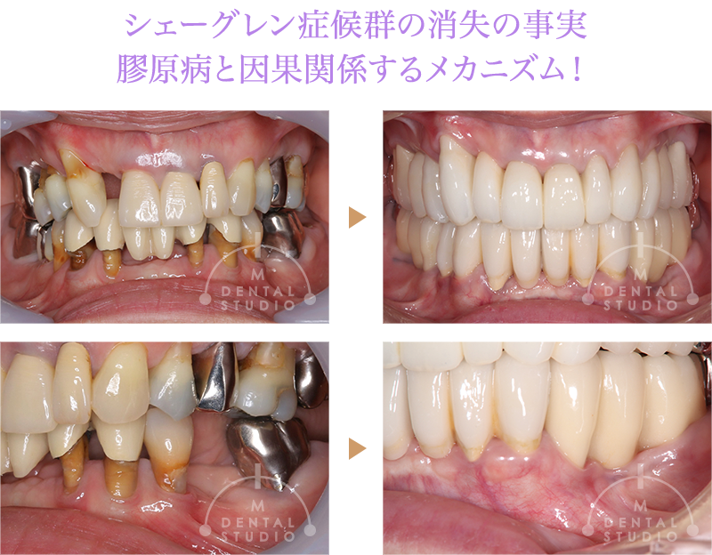 case_13