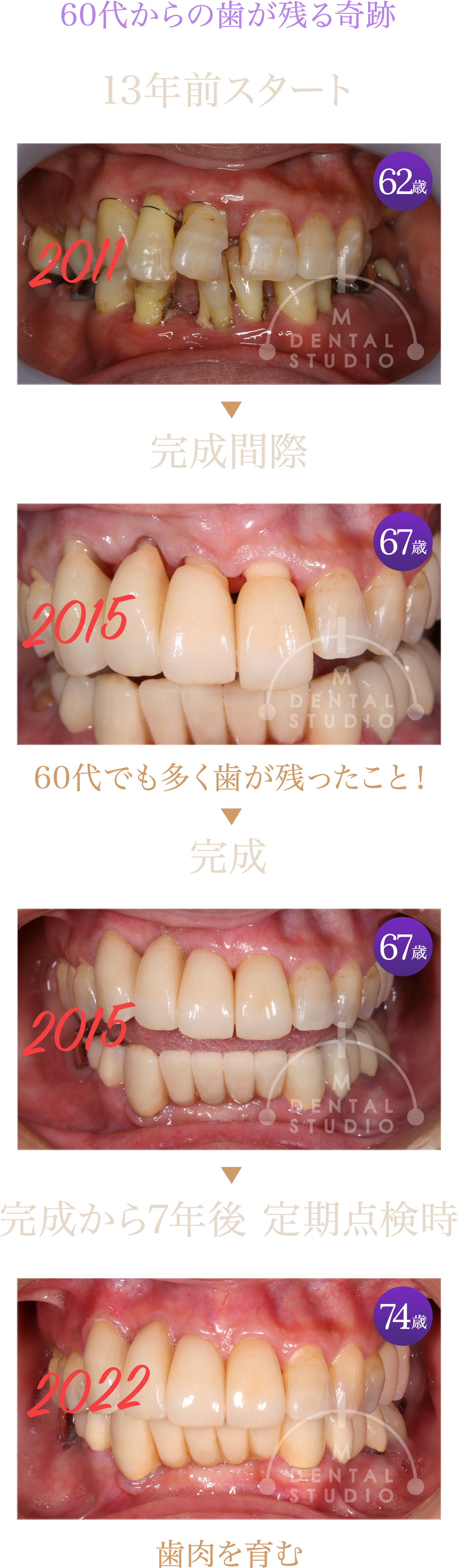 case_14
