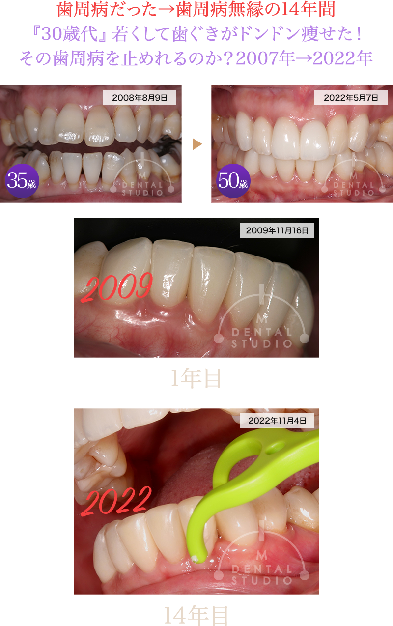 case_15